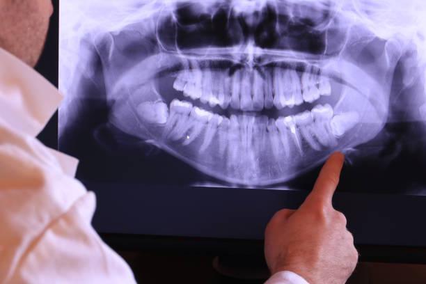Best Pediatric Emergency Dentist in Lofall, WA