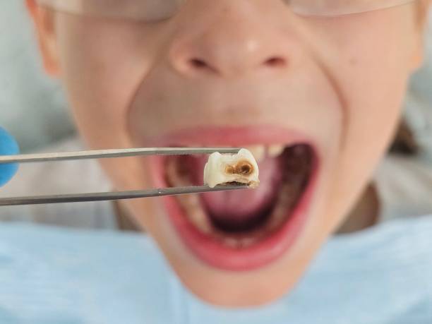 Best Emergency Denture Repair in Lofall, WA
